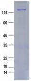 SDS-PAGE (COL7A1-1006HFL).jpg